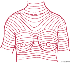 Bild som visar de Langerska linjerna, kvinnas �verkropp